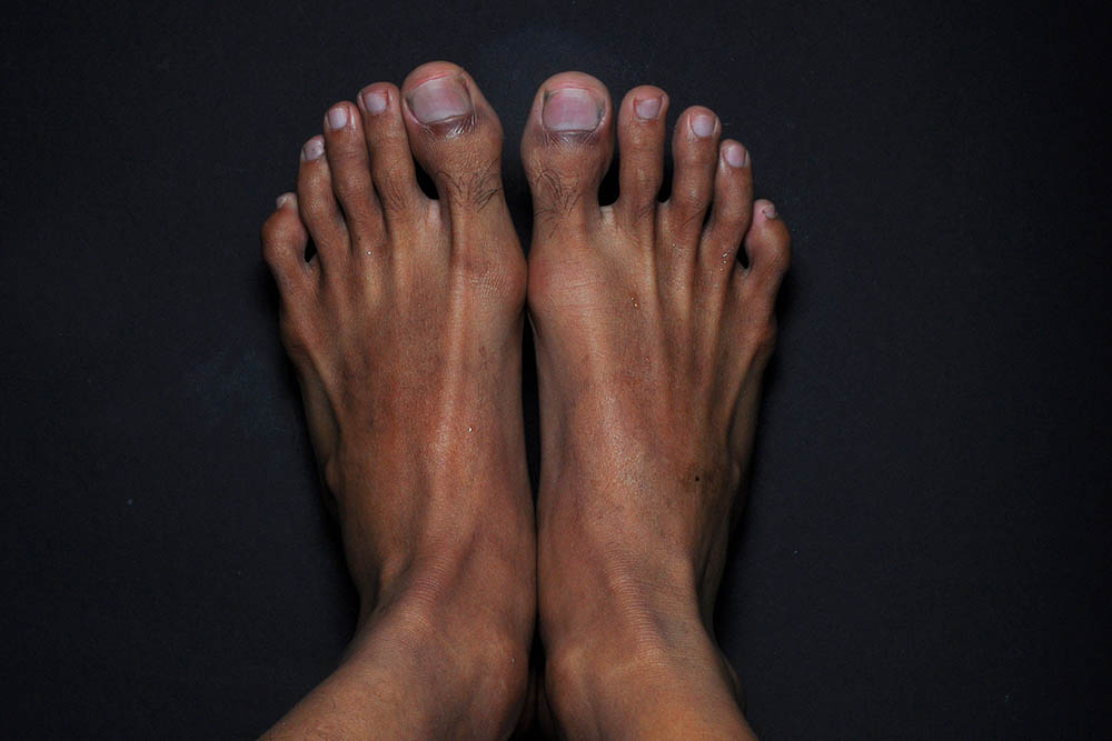 Feet